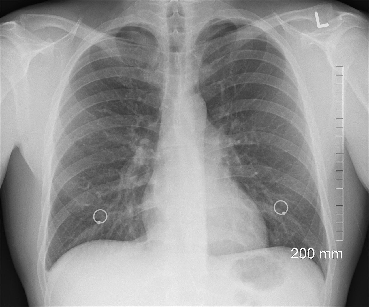diagnosis-1476620_1280 diagnosis-1476620_1280