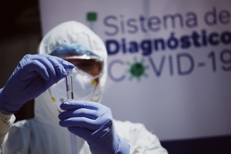 Desde el inicio de la pandemia se ha dado esta práctica Desde el inicio de la pandemia se ha dado esta práctica