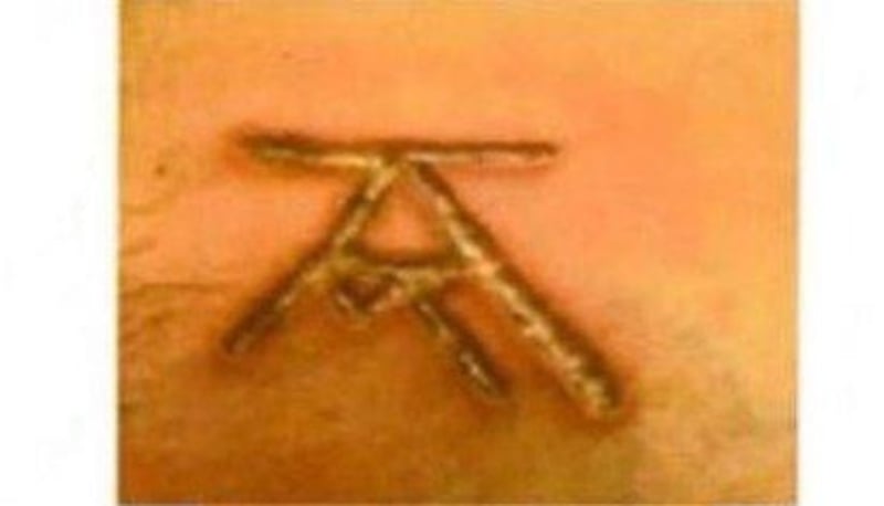 Una de las marcas hechas a una de las víctimas Una de las marcas hechas a una de las víctimas