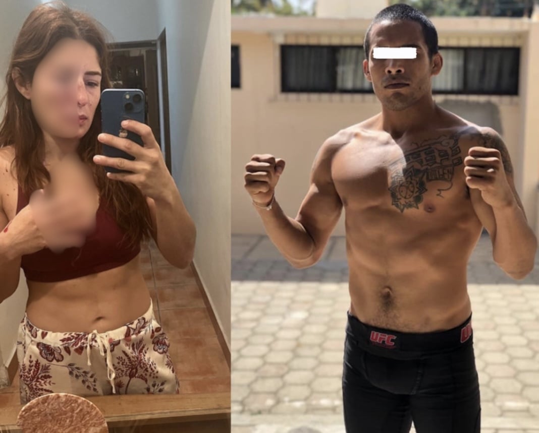 ‘Nunca pensé que esto me fuera a pasar a mí’: La luchadora Daniela López denuncia brutal agresión