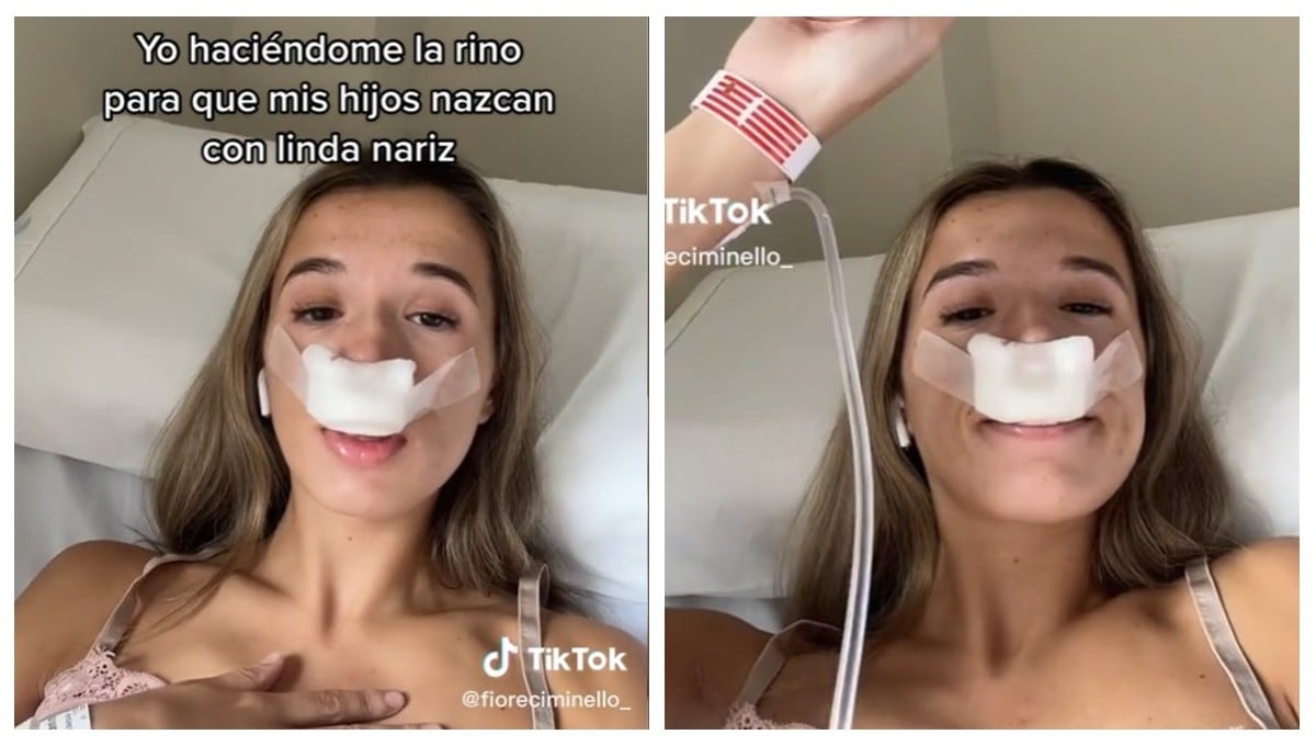 Influencer se hace rinoplastia para que sus hijos nazcan con nariz linda y se burlan